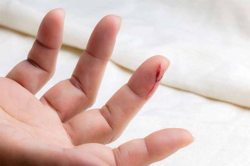 Mơ thấy đứt tay chảy máu đánh con gì? Giải mã giấc mơ 5 mơ thấy đứt tay chảy máu